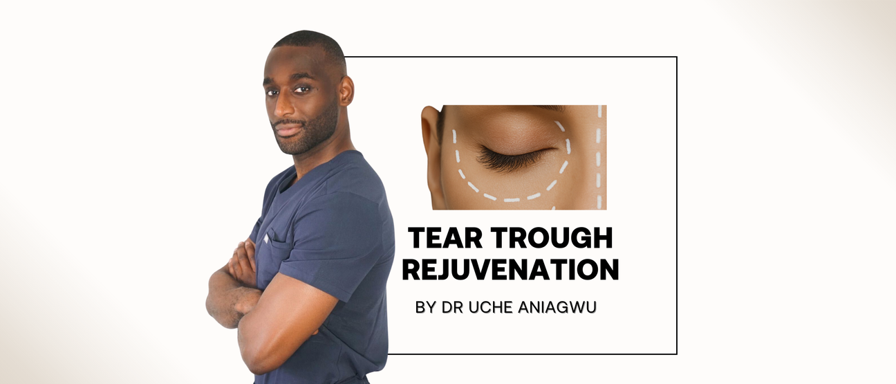 Tear Trough Rejuvenation: How Structured Marking Enhances Precision and Safety